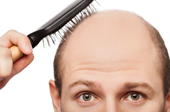 نکاتی برای بهبود و درمان ریزش مو