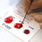 رابطه بین گروه خونی شما و خطر سکته زودرس