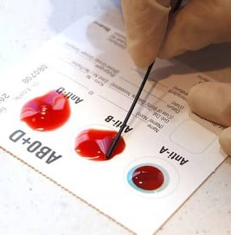 رابطه بین گروه خونی شما و خطر سکته زودرس